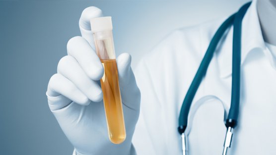Việc điều trị sẽ tùy thuộc vào nguyên nhân gây tăng bạch cầu trong nước tiểu.
