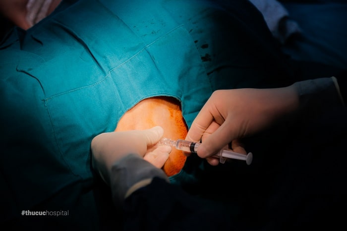 Gây tê tủy sống là kỹ thuật quan trọng trong đẻ mổ