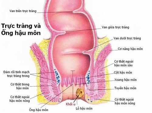 Ung thư hậu môn là sự phát triển bất thường của các tế bào ở hậu  môn. 
