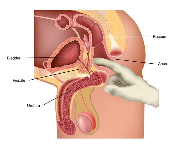 Tầm soát ung thư tuyến tiền liệt ở đâu