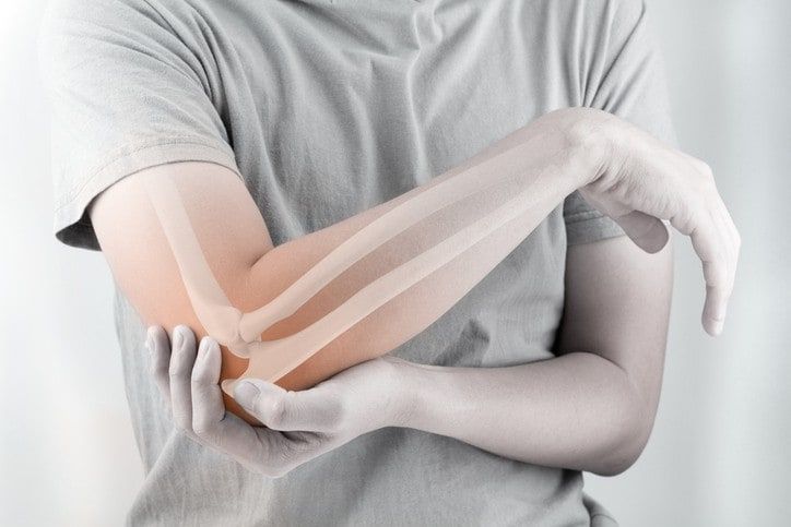 Trật khớp khuỷu tay bao lâu thì khỏi?Cách chữa hiệu quả nhất 2