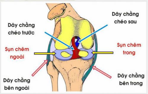 Đứt dây chằng chéo trước rách sụn chêm