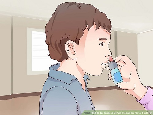 Thận trọng với cả thuốc xịt mũi là việc người bệnh viêm xoang nên nhớ
