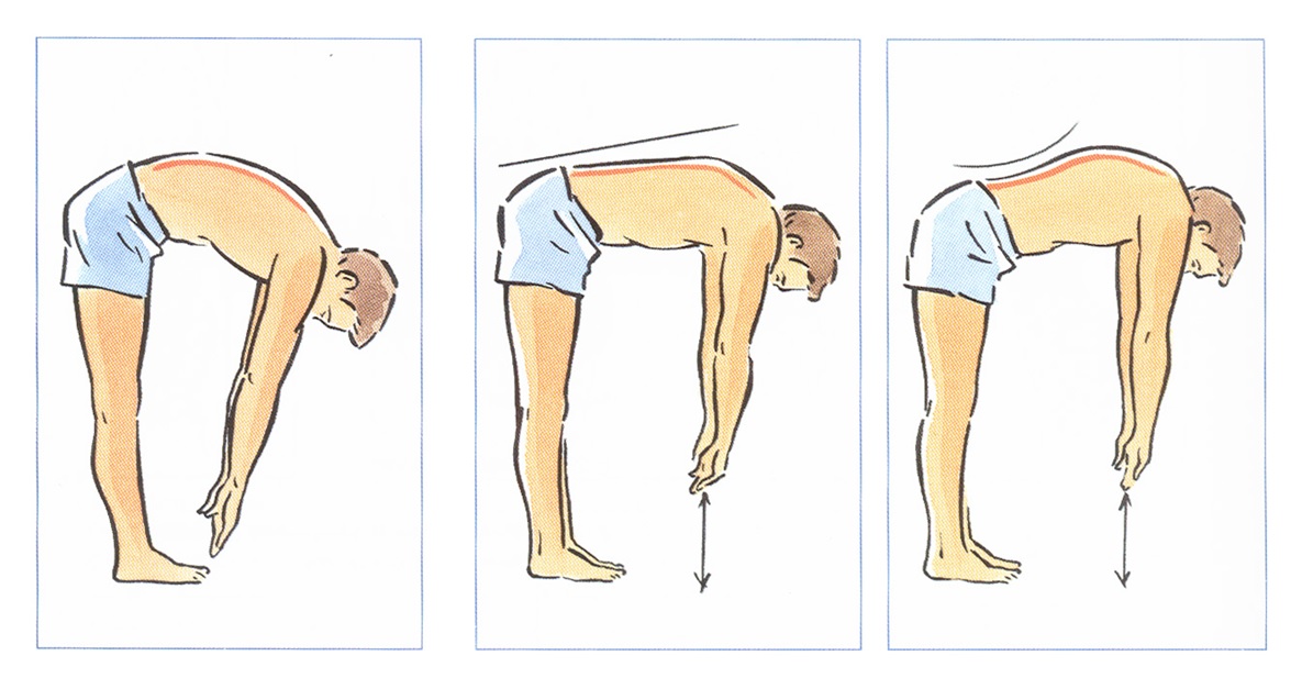 Nghiệm pháp Lasègue trong chẩn đoán hội chứng Thắt Lưng - Hông Nghiệm pháp Lasègue trong chẩn đoán hội chứng Thắt Lưng - Hông