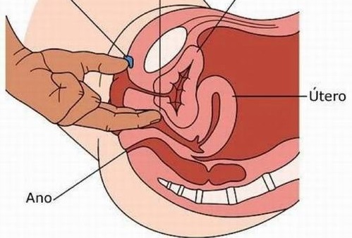 Bạn cần đi khám để bác sĩ kiểm tra hậu môn, tìm kiếm khối u