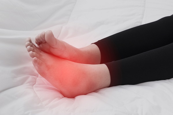 Chân sưng to bất thường cũng là dấu hiệu của bệnh ung thư bàng quang