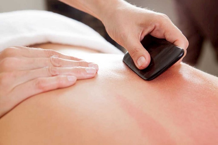 Cạo gió là phương pháp chữa cảm lạnh, cảm gió, mệt mỏi hiệu quả, tiết kiệm nên được nhiều người tin dùng