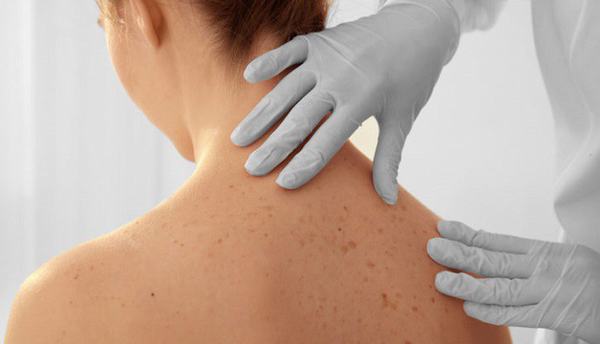 Khi có bất thường trên da, bạn cần đi khám ngay để được chẩn đoán chính xác tình trạng sức khỏe