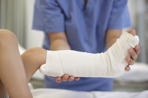 Một số lưu ý khi bó bột xương cẳng chân