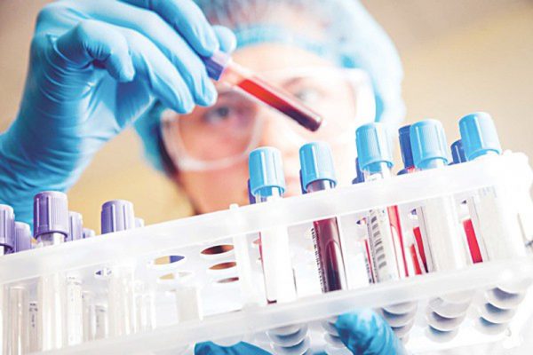 Xét nghiệm máu tìm chất chỉ điểm ung thu 