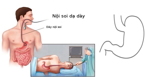 Phòng khám nội soi dạ dày Công Nghệ Cao - Không Đau tại Hà Nội