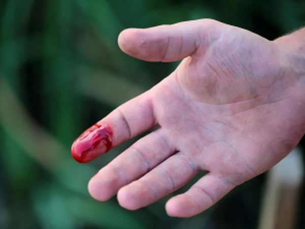 Cách cầm máu khi bị đứt tay sâu thế nào