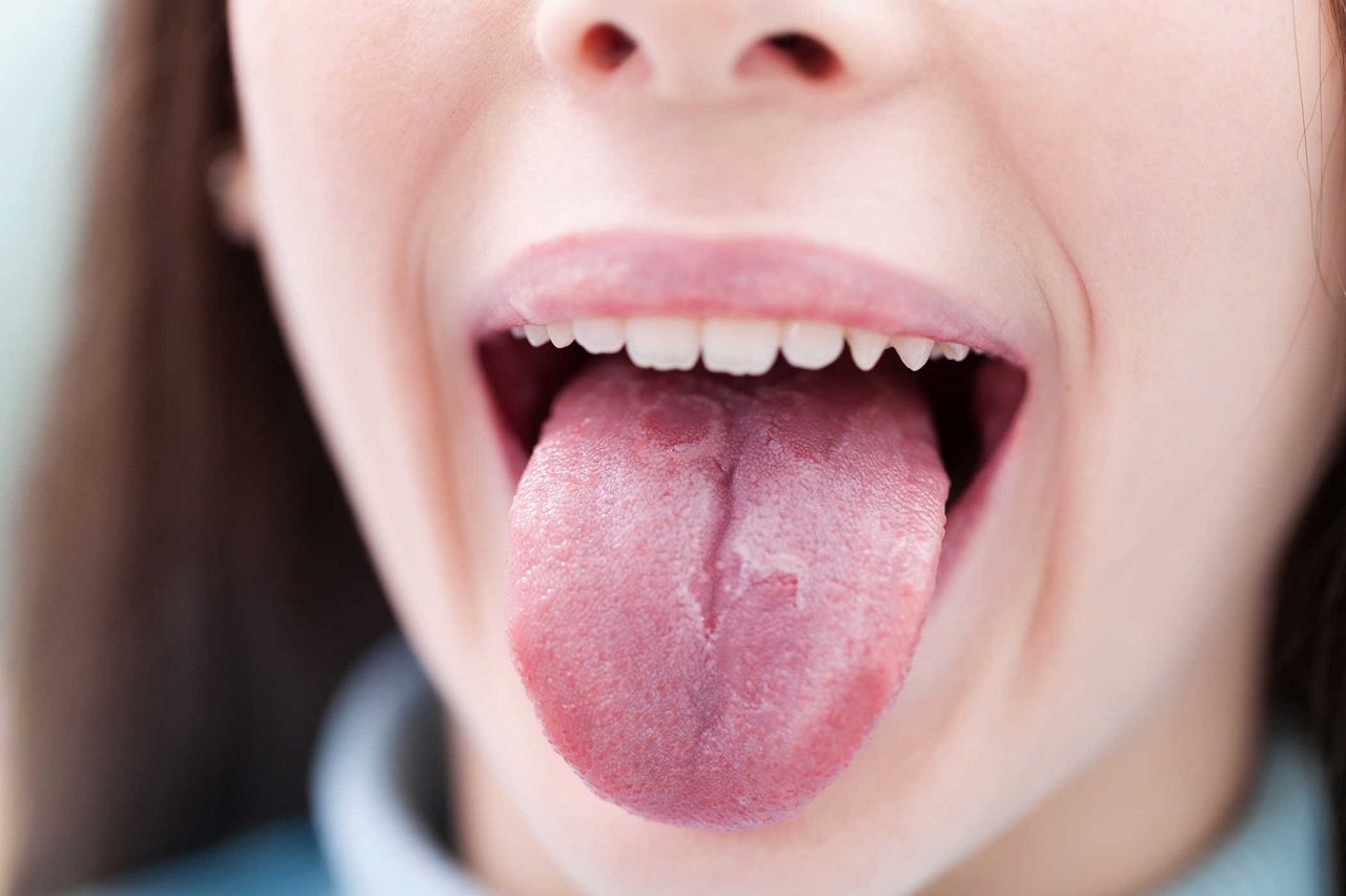 KHÁM LƯỠI TẠI CHUYÊN KHOA RĂNG HÀM MẶT HOẶC TAI MŨI HỌNG TÙY TRIỆU CHỨNG BAN ĐẦU