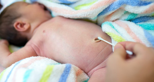 Vệ sinh rốn đúng cách cho trẻ là vấn đề được nhiều ba mẹ quan tâm