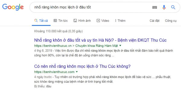 nhổ răng khôn