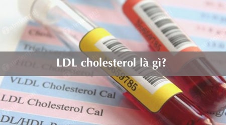 Định lượng LDL cholesterol là gì? Các yếu tố làm tăng