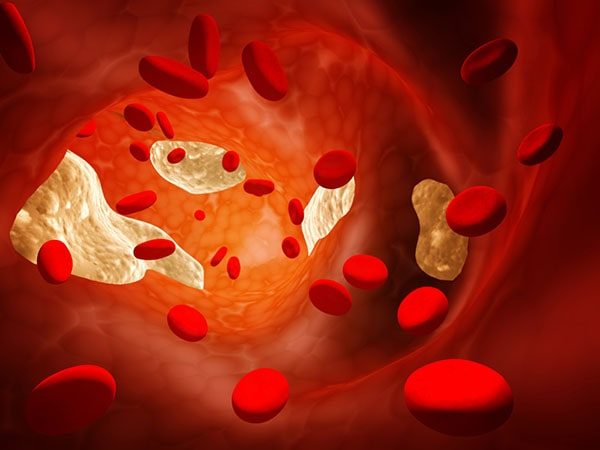 định lượng triglycerid bao nhiêu là bình thường