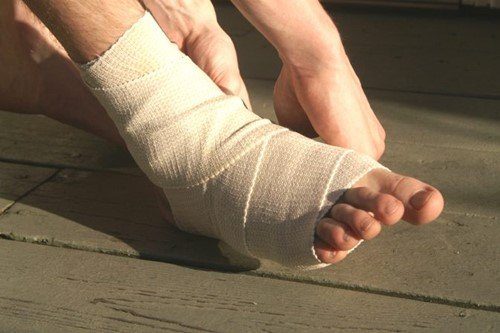 Giãn dây chằng mắt cá chân là loại tổn thương thuộc xương cổ chân và đây cũng là vị trí thường xảy ra chấn thương nhất điều trị giãn dây chằng mắt cá chân bằng thuốc