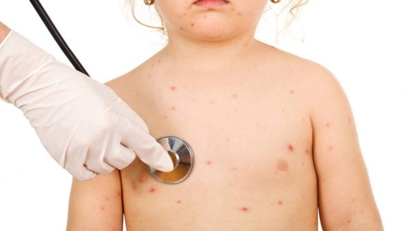 Bệnh do nhiều yếu tố như bẩm sinh, di truyền, trẻ bị nhiễm virus, vi trùng hay các bệnh tăng, hủy tiểu cầu