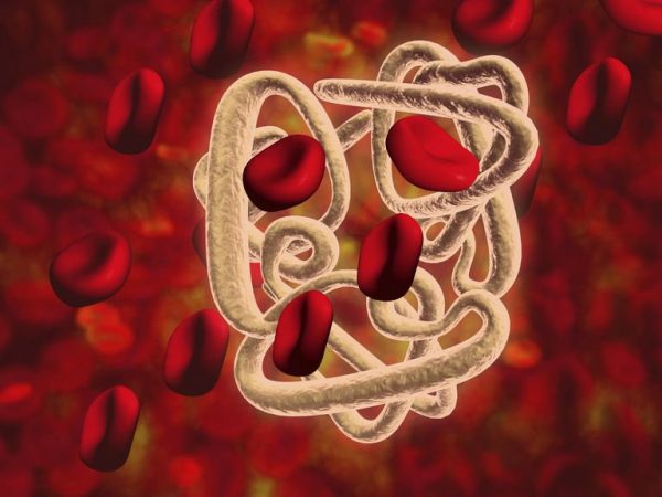 phát hiện thalassemia
