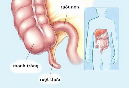 Tổng hợp các thông tin cần biết về mổ ruột thừa