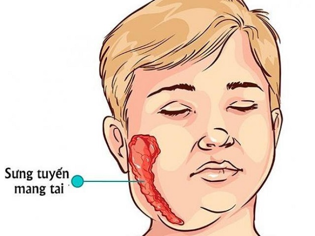 tỷ lệ bạch cầu mono tăng cảnh báo bệnh gì