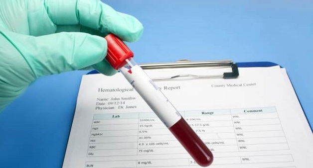 chỉ số lymphocytes giảm