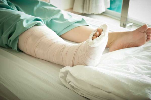 Bó bột thường được áp dụng khi gãy xương mác mức độ nhẹ