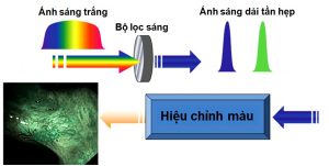 kỹ thuật nội soi với giải tần ánh sáng hẹp NBI