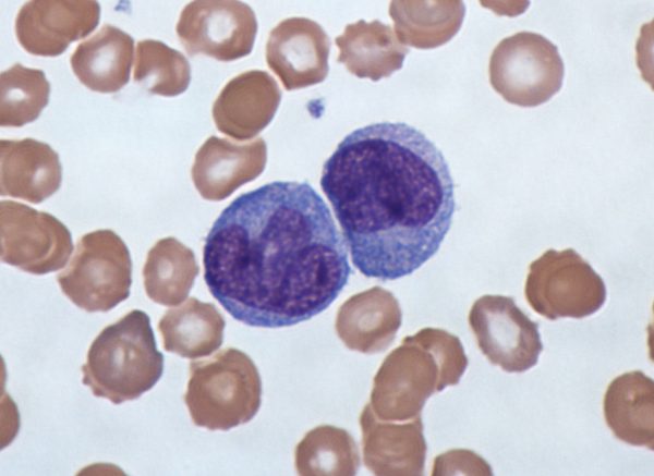 monocyte là gì?