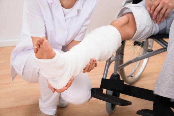 Nẹp xương và bó bột là một trong những phương pháp được áp dụng trong điều trị gãy xương mác