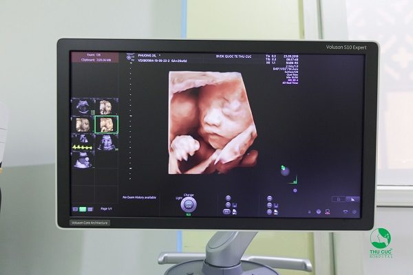 Công nghệ siêu âm 5D hiện đại tại Bệnh viện ĐKQT Thu Cúc