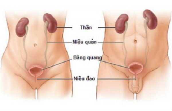Nguyên nhân hình thành sỏi niệu đạo