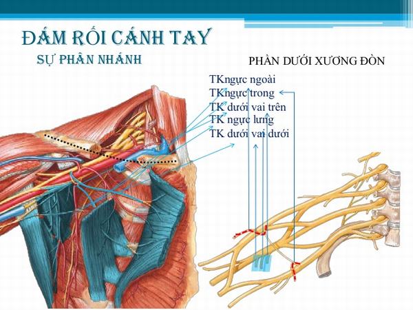 Mỗi cánh tay có một đám rối thần kinh.