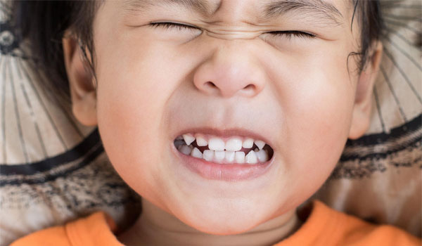 Nghiến răng quá nhiều có thể gây ra những ảnh hưởng nghiêm trọng cho răng và là một trong những nguyên nhân gây đau quai hàm (ảnh minh họa)