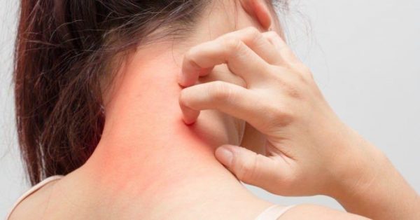ngứa khắp người là bệnh gì?