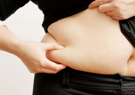 Người mắc bệnh béo phì dễ có nguy cơ mắc bệnh sỏi túi mật. 