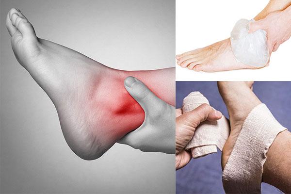 Xương cổ chân dễ bị các chấn thương như bong gân, nứt gãy