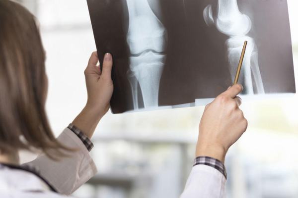 Tùy vào mức độ gãy xương bác sĩ sẽ chỉ định phương pháp điều trị phù hợp