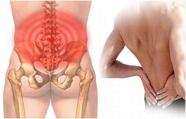 Giãn dây chằng thường không gây nguy hiểm tới tính mạng