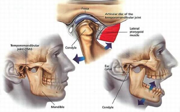 Ngáp lớn hoặc cười to, nằm ngủ sai tư thế... là những nguyên nhân gây sái quai hàm