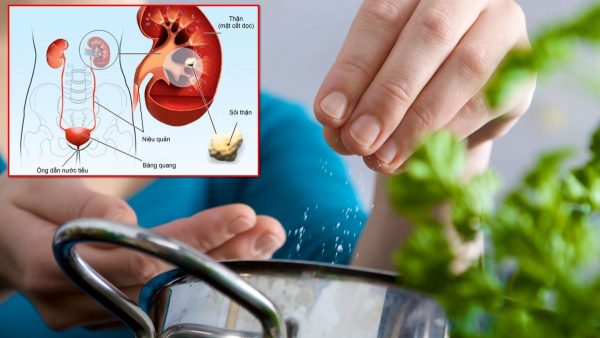 Chế độ ăn uống không lành mạnh: ăn nhiều muối, ăn quá nhiều thực phẩm chứa hàm lượng cao oxalate, canxi… là những nguyên nhân chính gây bệnh sỏi thận (ảnh minh họa)