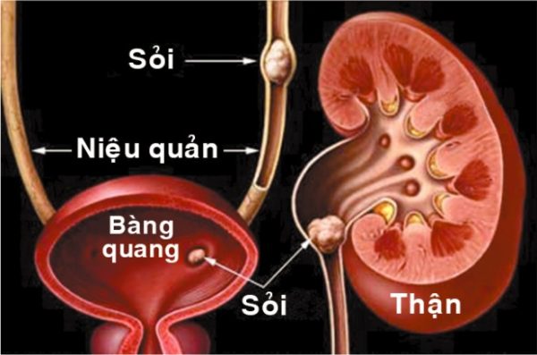 tan soi noi soi nguoc dong bang laser