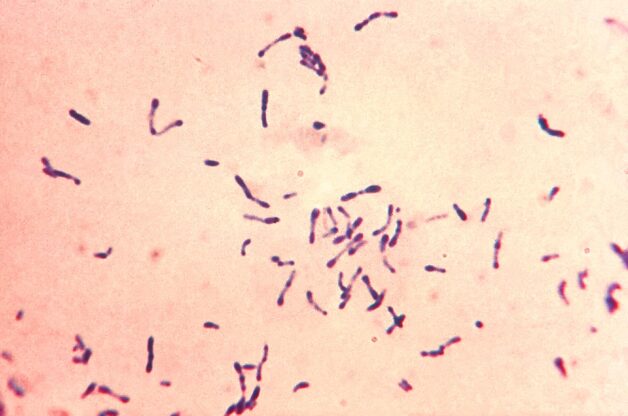 Trực khuẩn Corynebacterium diphtheriae là trực khuẩn gram dương, hình chùy