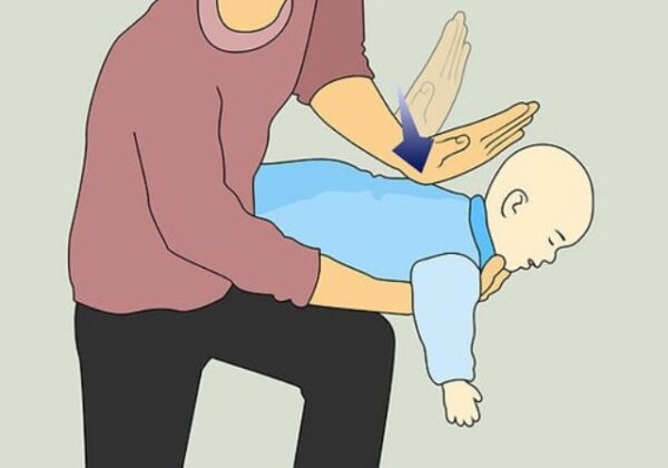 Xử trí hóc dị vật ở trẻ em với trẻ dưới 2 tuổi