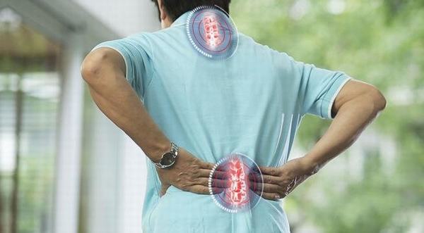 Người bệnh thường có cảm giác đau lưng và các vị trí bị vôi hóa dữ dội, tê cứng xương khớp