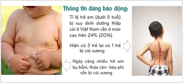 trẻ còi xương thể bụ vì sao