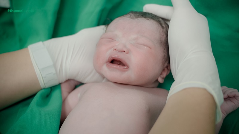 Sau khi sinh, bé được bác sĩ Nhi - Bệnh viện Thu cúc kiểm tra sức khỏe sơ bộ, đánh giá các phản xạ đầu đời để đảm bảo bé hoàn toàn khỏe mạnh.