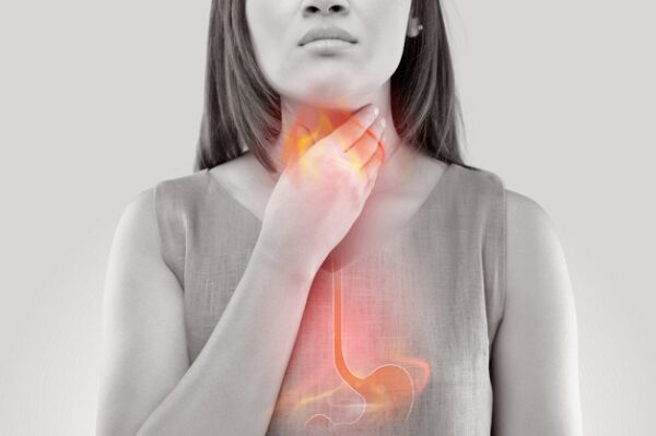 Trào ngược dạ dày thực quản là 1 trong các bệnh tiêu hóa thường gặp