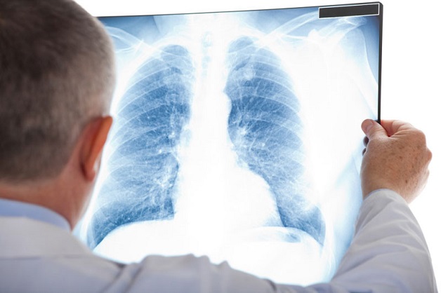 Chụp X quang là phương pháp mang lại nhiều giá trị trong chẩn đoán và điều trị